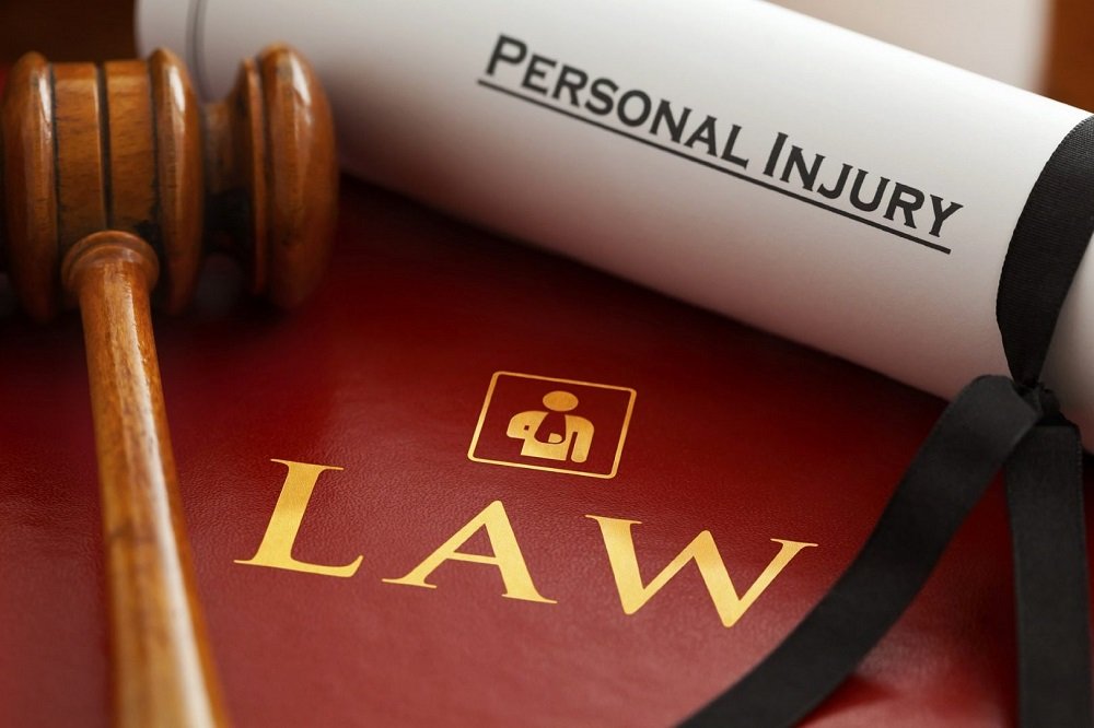 Three Important Factors to Consider When Hiring a Personal Injury Attorney Who Specializes in TBI